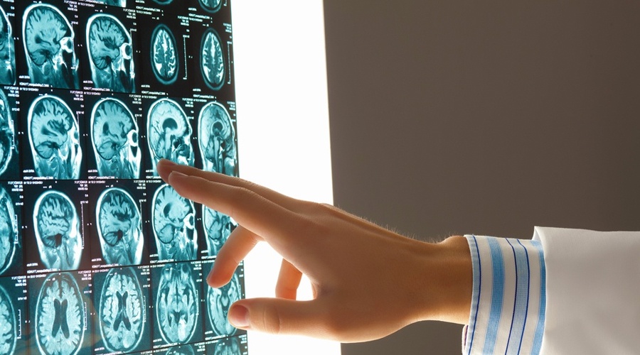 HBOT BECOMING INCREASINGLY POPULAR BRAIN INJURY THERAPY HBOT BECOMING INCREASINGLY POPULAR BRAIN INJURY THERAPY
