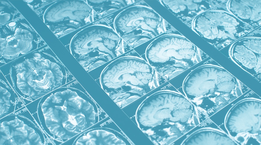 WHAT IS ANOXIA? WHAT IS ANOXIA?